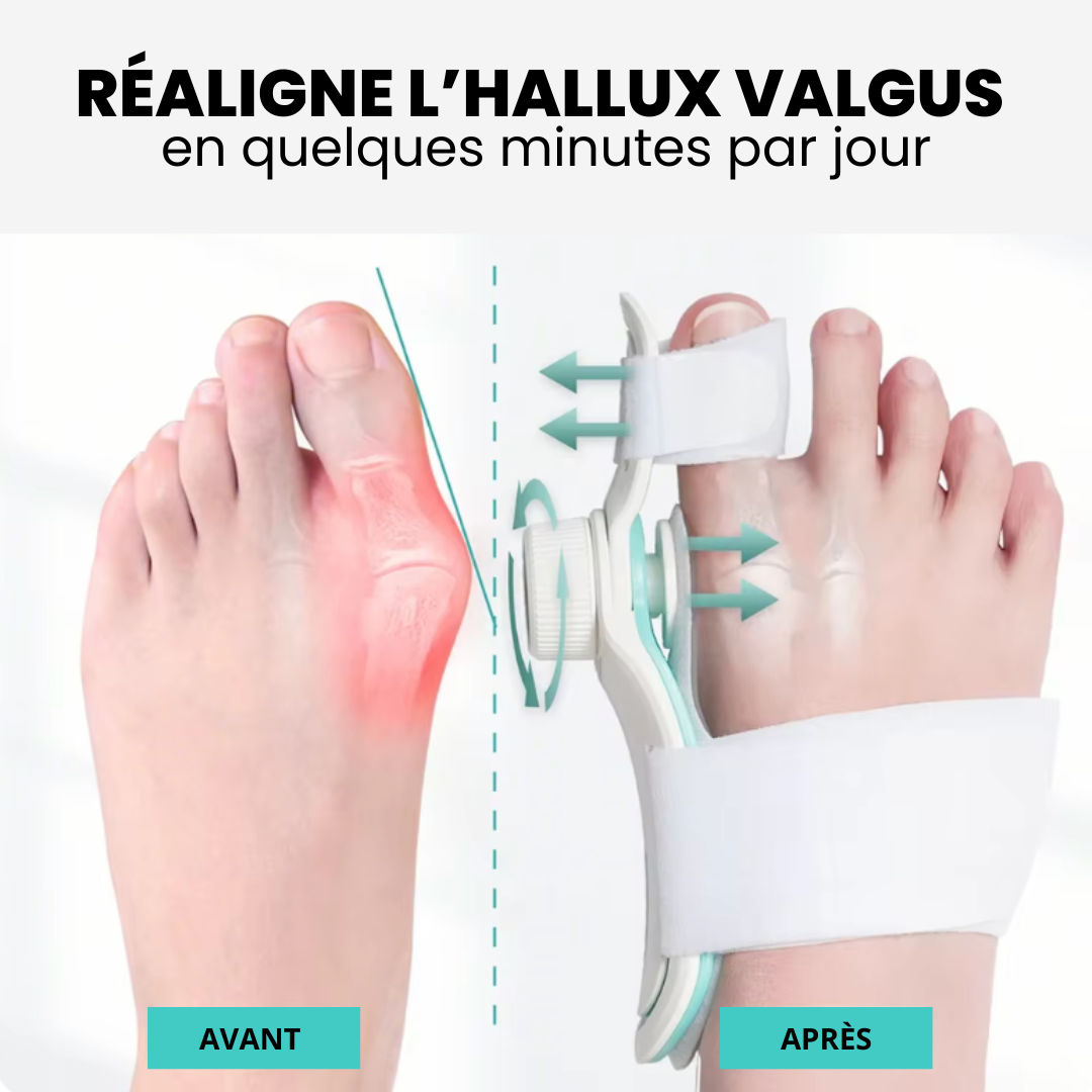 ValgusPro - Correcteur d'Hallux Valgus